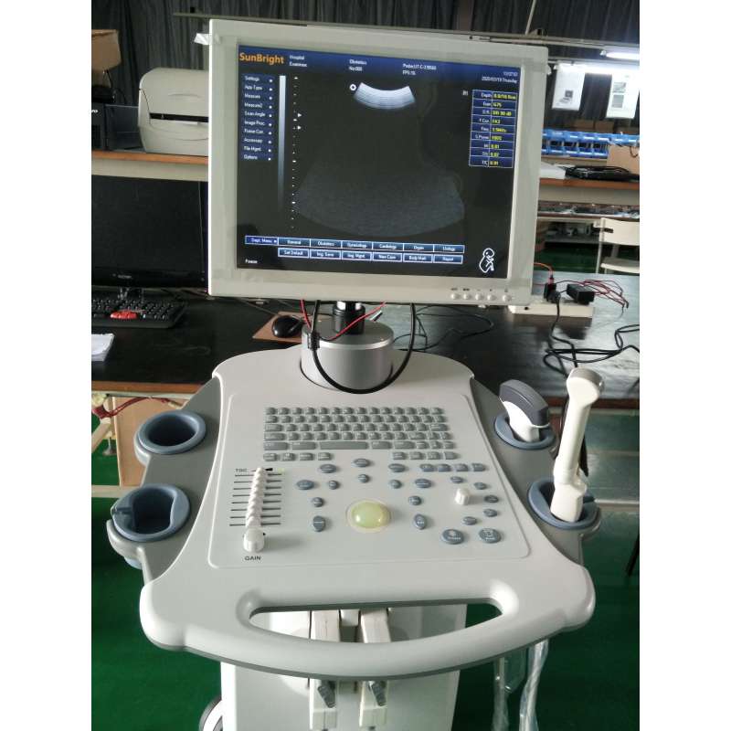 Factory Price Portable high quality 3d ultrasound machine trolley for hospital
