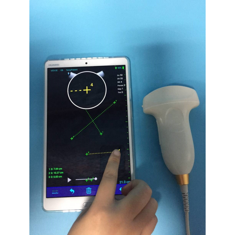 portable advanced hospital direct manufacturer usb mobile phone ultrasound probe
