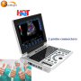 Discount price ultrasound scanner ultrasonic machine for muscles