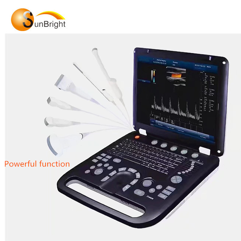 Portable 3D 4D Color Doppler Ultrasound with usg portable
