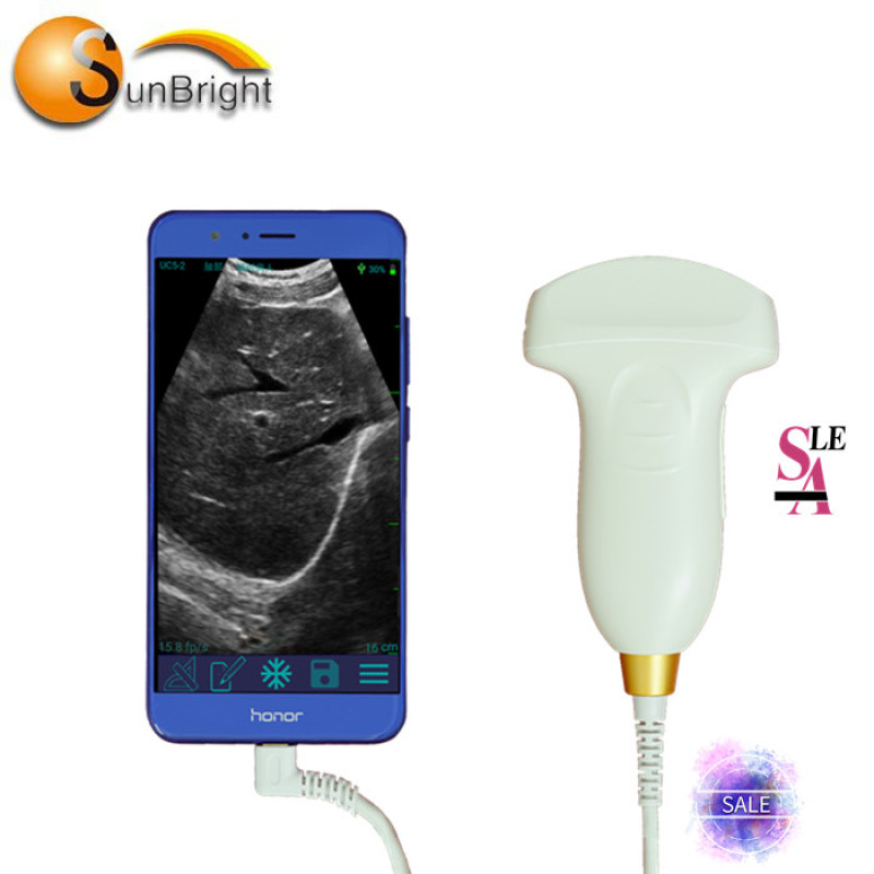 Sonde à ultrasons usg sans fil 2.5-10Mhz pour iphone ipad USB vente de sonde convexe