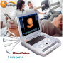 Medical Equipment pregnancy scanner ultrasound 3D on Sale