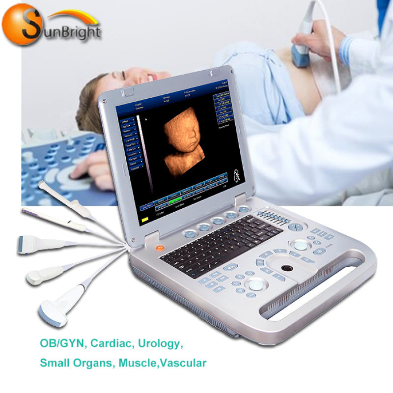 laptop 3D echo machine ultrasound scanner price medical device