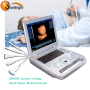 laptop 3D echo machine ultrasound scanner price medical device