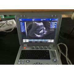 veterinary ultrasound equipment/ultrasound scanner used on Animal/ultrasound machine for veterinary pregnancy