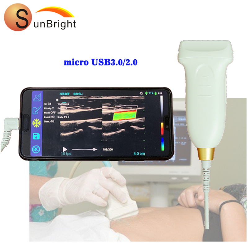 sonda ecografica portatile per iPhone/Android con connessione wireless per macchine ecografiche sonda lineare