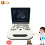 Hospital Cheap Price Portable Ultrasound Machine 2 Probe Connectors Lightweight Ultrasound