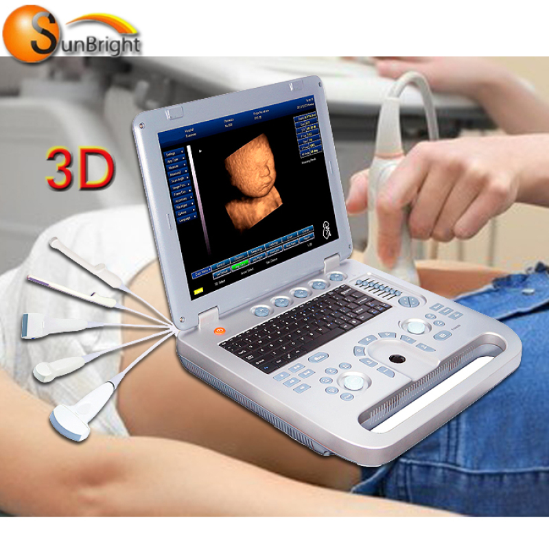 Portable cheapest 3D sonography ultrasound scanner fetal scanning for hospital