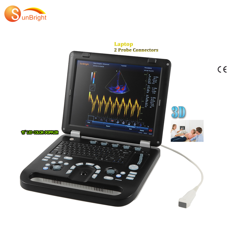 Human hospital use 3D laptop color Doppler ultrasound scanner price with 2 probe connectors