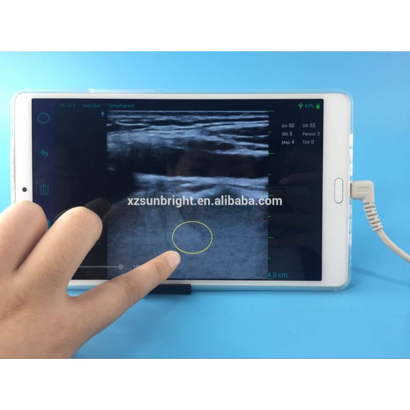 Portable b/w 2d usb linear probe ultrasound diagnosis system new arrived portable ultrasound probe SUN-P2