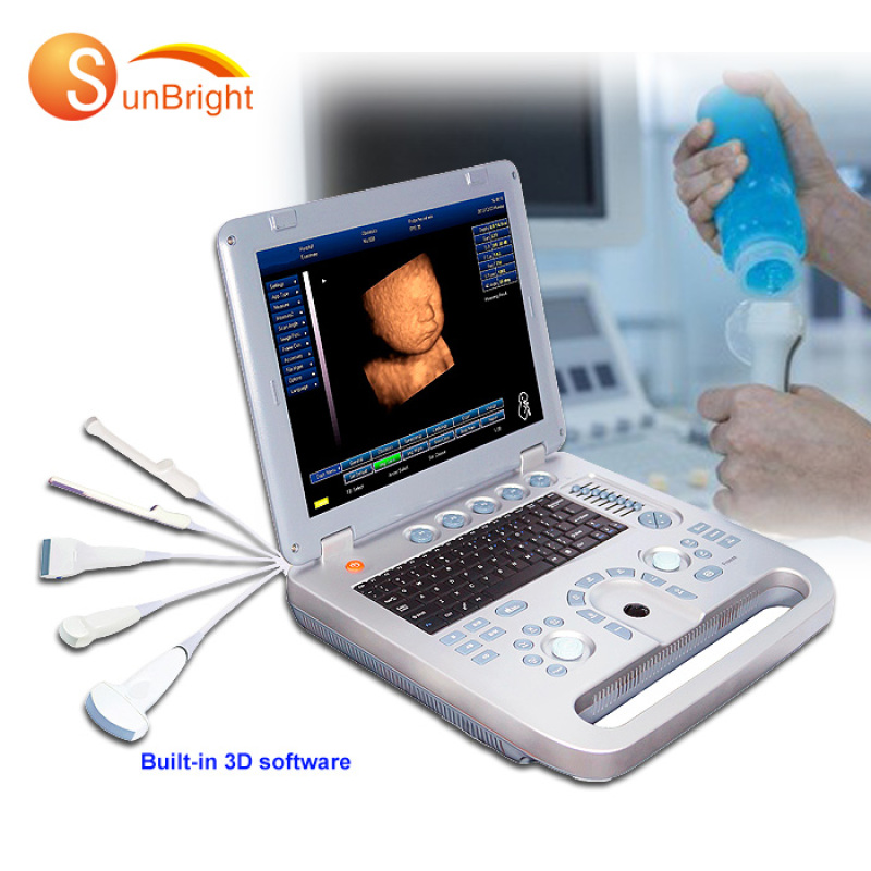 high resolution full didital 3D free laptop ultrasound DICOM 3.0 ultrasound medical device