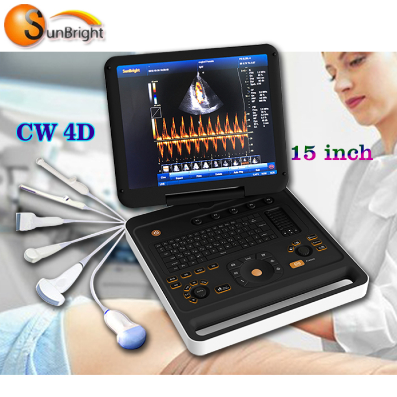 High end hospital laptop 4D color doppler ultrasound machine portable
