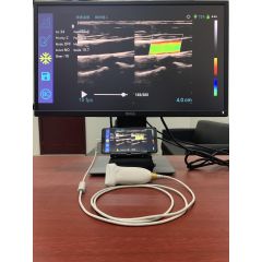 wireless ultrasound probe linear probe ultrasound machine price