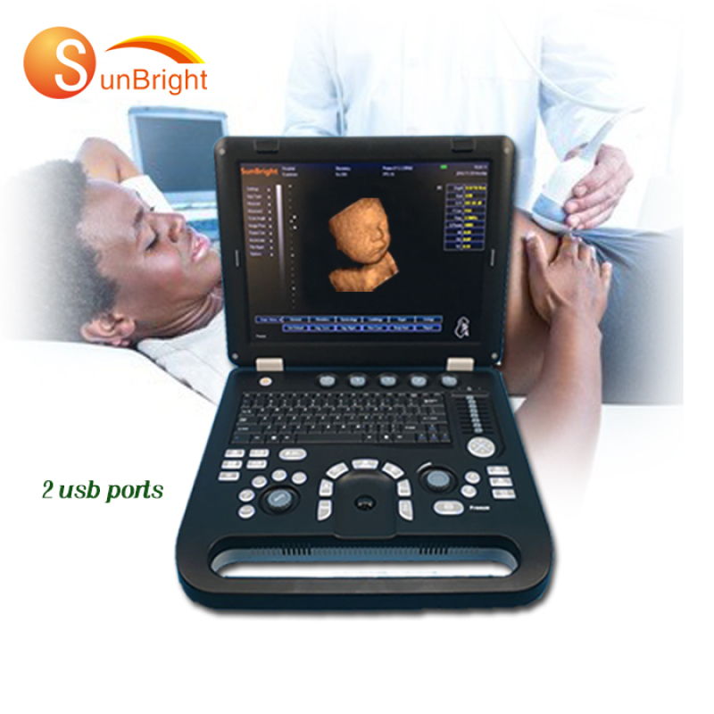 High quality portable Cardiac OB GYN 3D 4D Echocardiography ultrasound machine SUN-800D