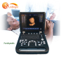 High quality portable Cardiac OB GYN 3D 4D Echocardiography ultrasound machine SUN-800D