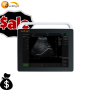 High Frequency portable laptop machine digital ultrasound scanner