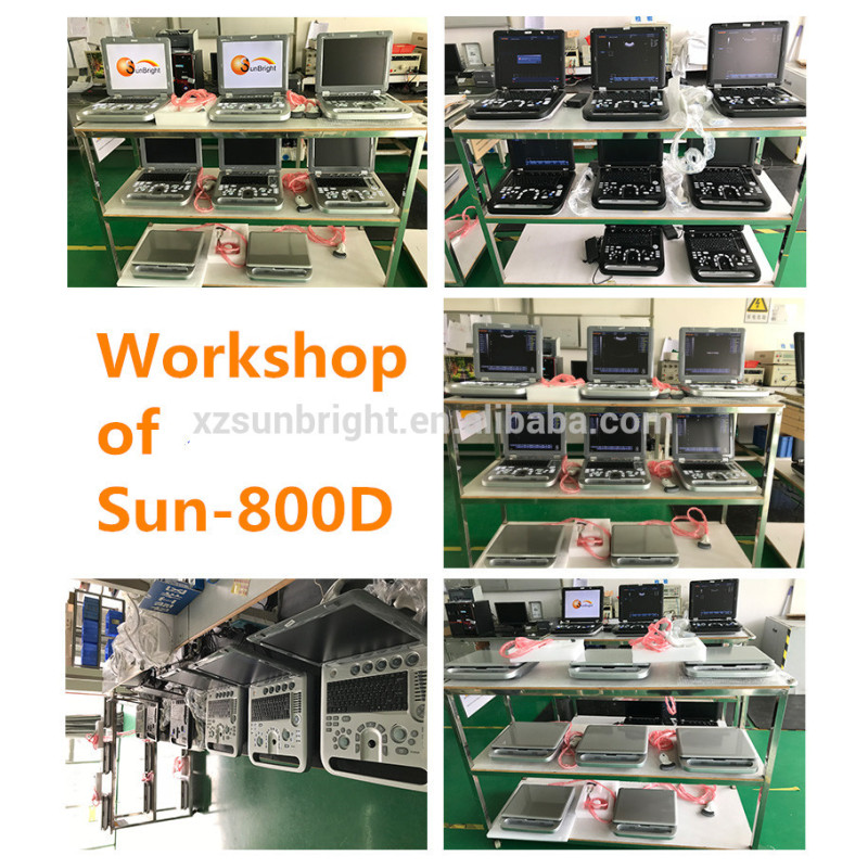 High quality laptop OB GYN ultrasound machine best price medical equine ultrasound machine