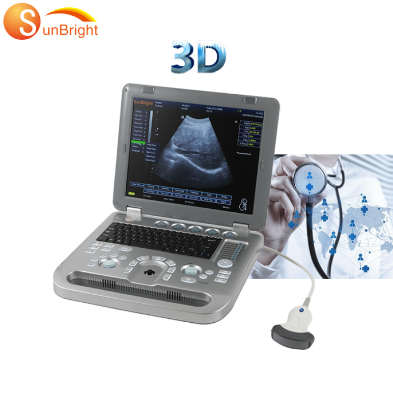 High image scan quality portable musculoskeletal ultrasound machine