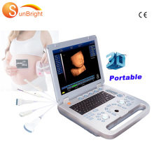100% return policy laptop 3D equine ultrasound machine SUN-800D with best promotion price