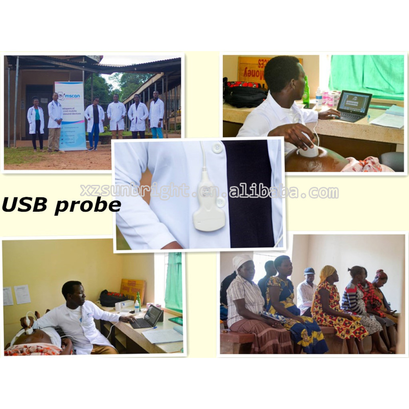 New Product USB&WiFi Ultrasound Linear Probe For Android/Windows Device cheapest ultrasound probe