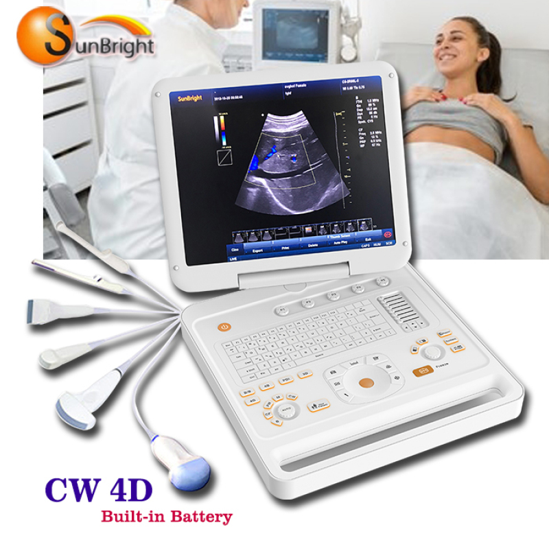 가성비 높은 복부 장기 컬러 도플러 휴대용 컬러 도플러 진단