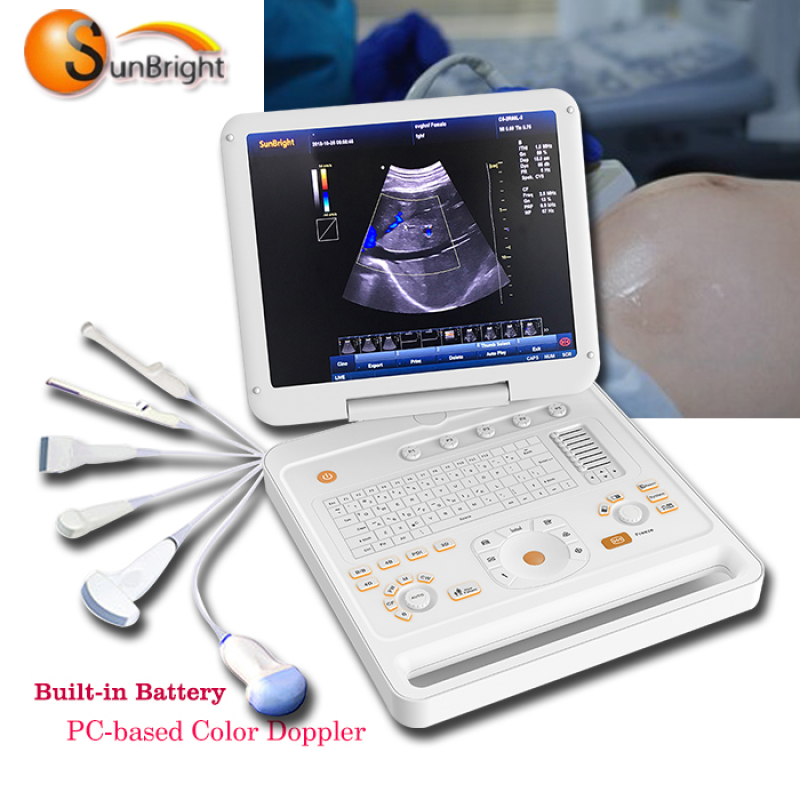 Equipo doppler color 4D de ecocardiografía fácil de operar