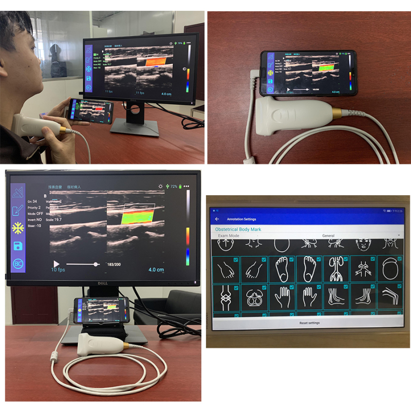 High quality vascular 128 elements ultrasound wireless USB probe ultrasound scanner linear color doppler