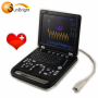 portable 4d ultrasound machine medical 3D OB GYN new color image digital doppler device