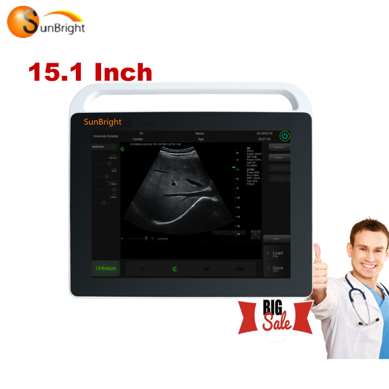 가장 저렴한 가격 15 인치 터치 스크린 의료 병원 진단 장비 임신을위한 휴대용 초음파 스캐너 기계