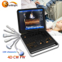 ISO/CE New design ultrasound CW PW medical device handheld Doppler_ultrasound_price