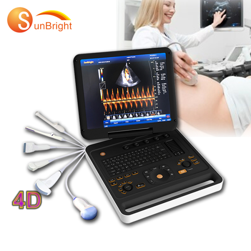Portable Medical Ultrasound Machine Cardiac 3D 4D Color Doppler clear image 4d ultrasound