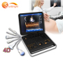 Portable Medical Ultrasound Machine Cardiac 3D 4D Color Doppler clear image 4d ultrasound