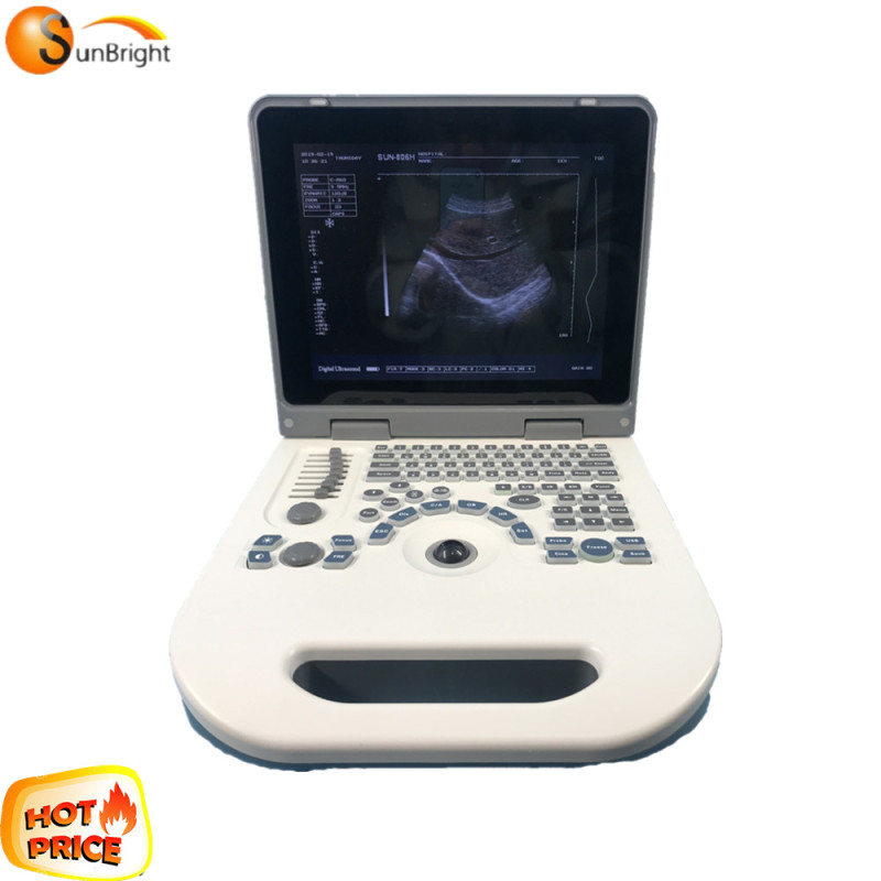 Black and white 2 probe connectors laptop portable echo ultrasound machine