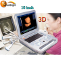 high end laptop medical hospital ob gyn 3d ultrasound machine price
