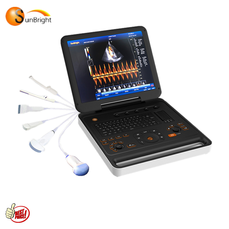 높은 비용 성능 휴대용 초음파 중국 제조업체가 직접 판매