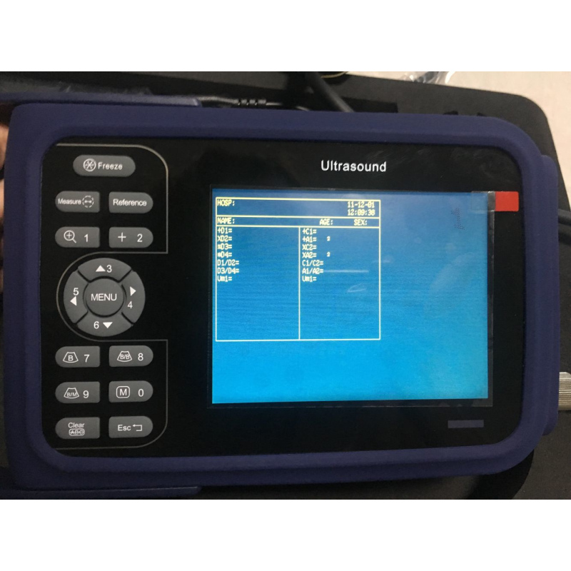 OB/GYN laptop ultrasound SUN-808F handheld hospital ultrasound device price