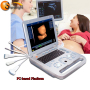 better than GE ultrasound portable 3D hospital clinic use cheap price ultrasound