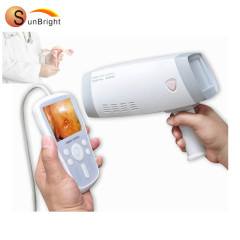 Sunbright video colposcope for gynecology examination