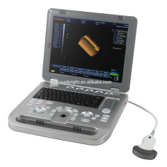Wide range smart 2D 3D machine Cheapest price portable ultrasound scanner and applications