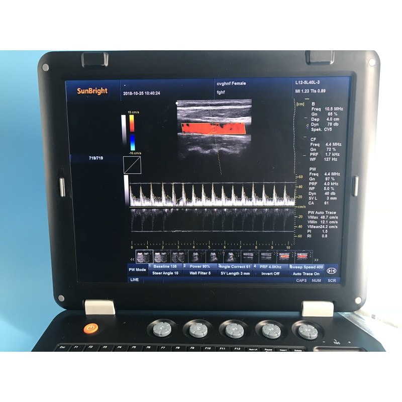 Cardiac CW medical new echocardiography color doppler 4D ultrasound machine price