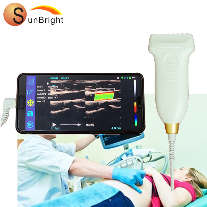 portable linear wireless wifi usg/usb color doppler android/pc ultrasound probe