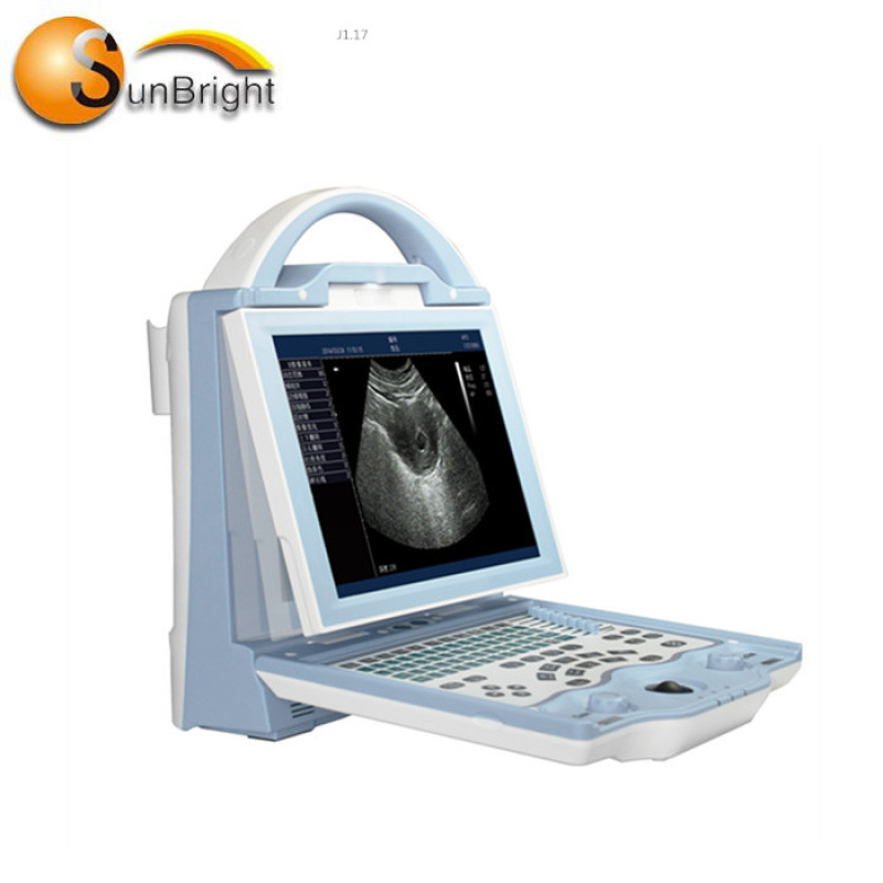 병원용 휴대용 디지털 초음파 스캐너 Sun-800W