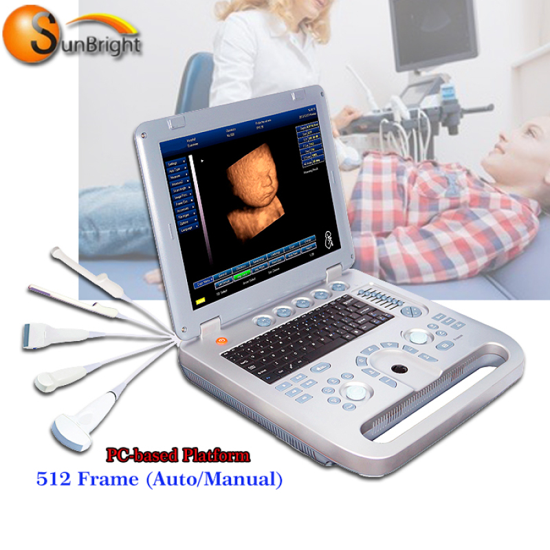 Factory Price B/W ultrasound Portable black and white ultrasound scanner machine Doppler