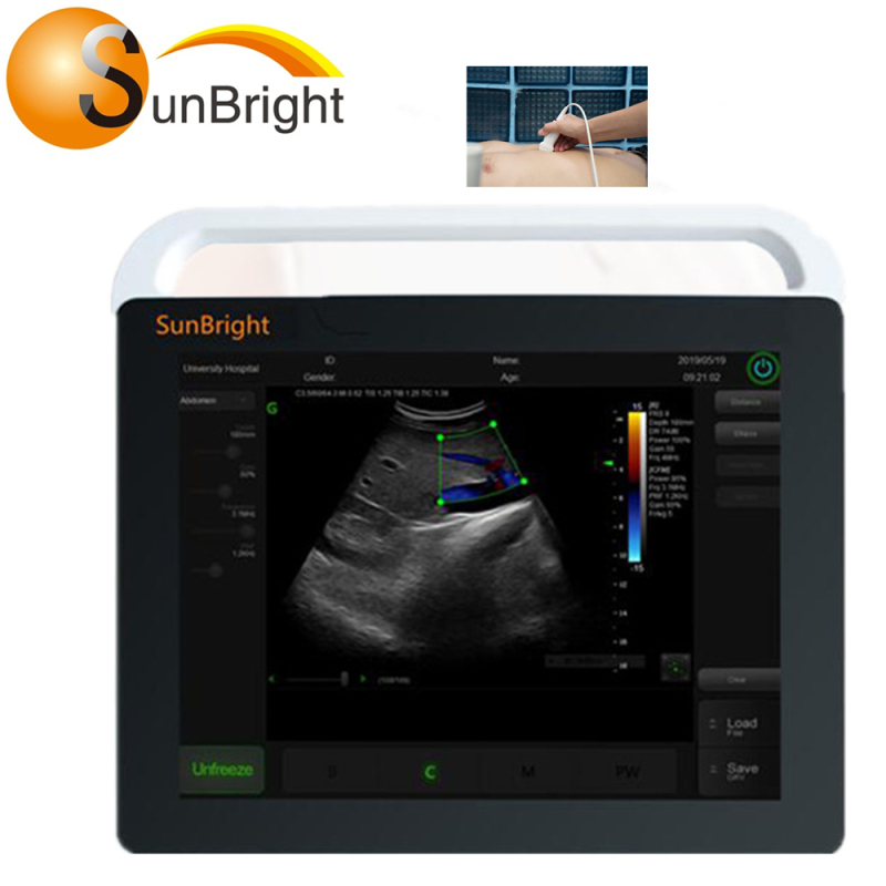 OB medical diagnostic equipment portable ultrasound scanner machine