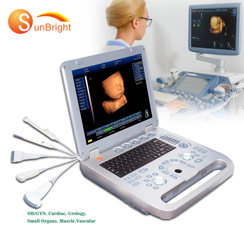 2020 color portable laptop portable ultrasound machine with low price