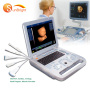 2020 color portable laptop portable ultrasound machine with low price