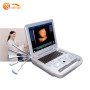 Échographie portable noir blanc de 15 pouces avec logiciel 3D gratuit et fonction multilingue
