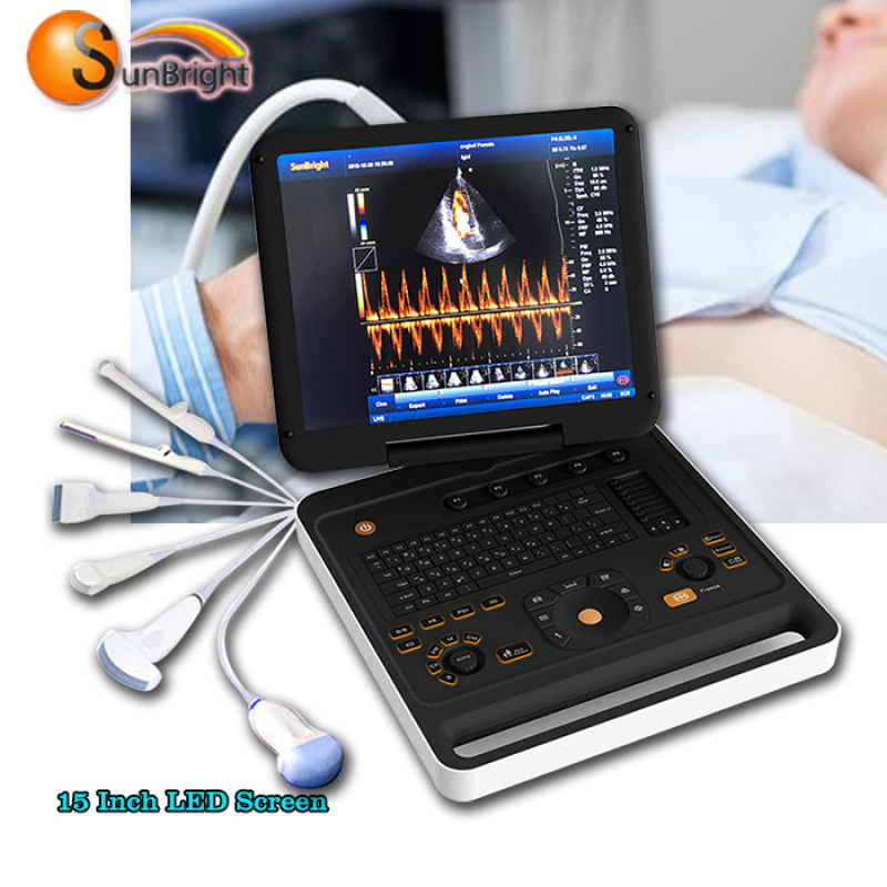 portable medical scanner high quality 3D CW Doppler 4D ultrasound equipment