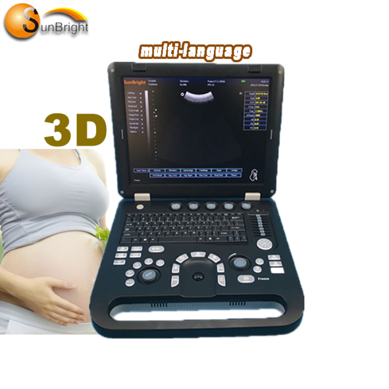 trolley cart ultrasound new popular model best price