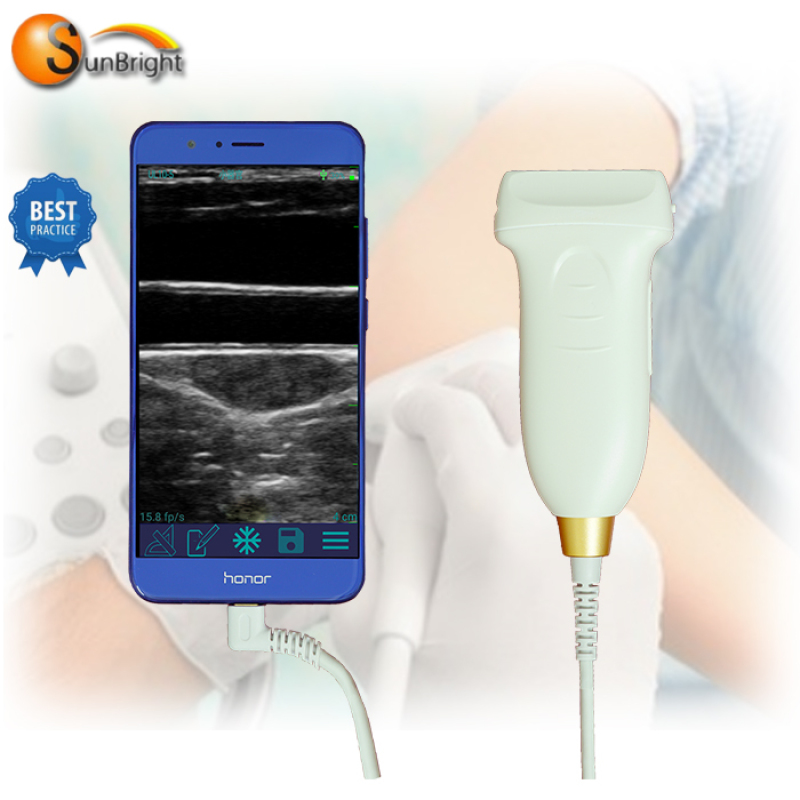 Factory price Portable ultrasound transducer gel Probe for sale